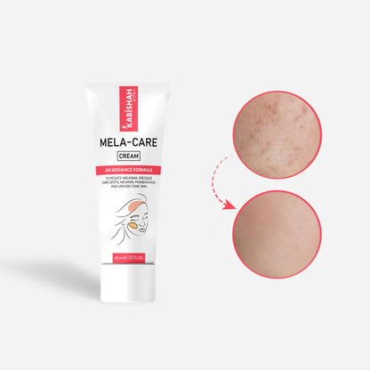 Kabishah  Melasma Bundle - 24 Hours Protection| LuminaBright Whitening Face Wash| Lumina Guard Daily Brightening Sunblock |Mela Care Advanced Brightening Cream